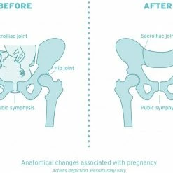 Hipslimmer Corset Post-pregnancy Support.